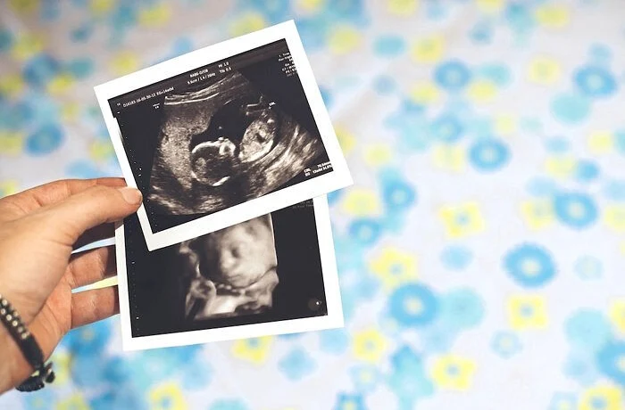 Верховный суд Джорджии восстановил &laquo;Закон о сердцебиении&raquo;, запрещающий аборты после 6-й недели берем